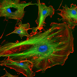 Eukaryote celler under et flourescensmikroskop